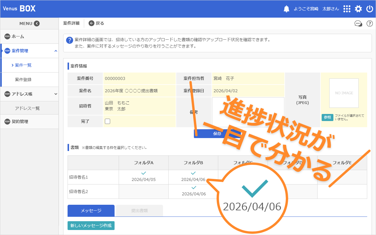 ビーナスボックスの特徴1